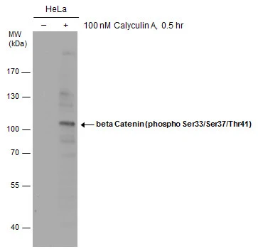 beta Catenin (phospho Ser33/Ser37/Thr41) antibody